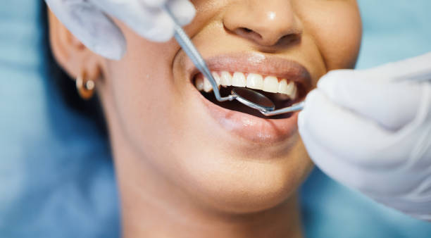 Best Emergency Tooth Extraction in Ashwaubenon, WI