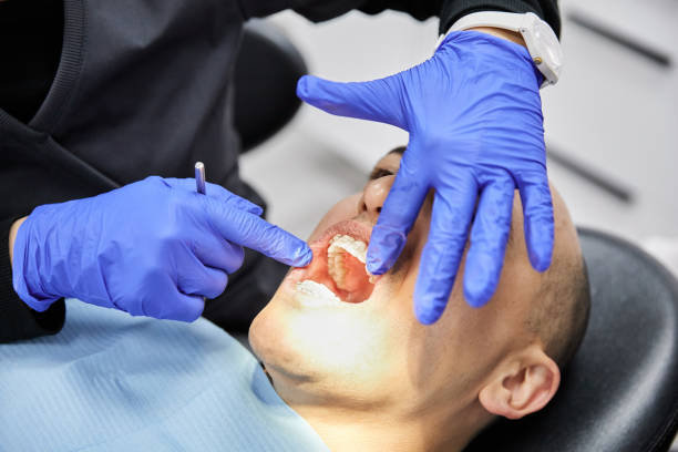 Best Emergency Wisdom Teeth Removal in Ashwaubenon, WI